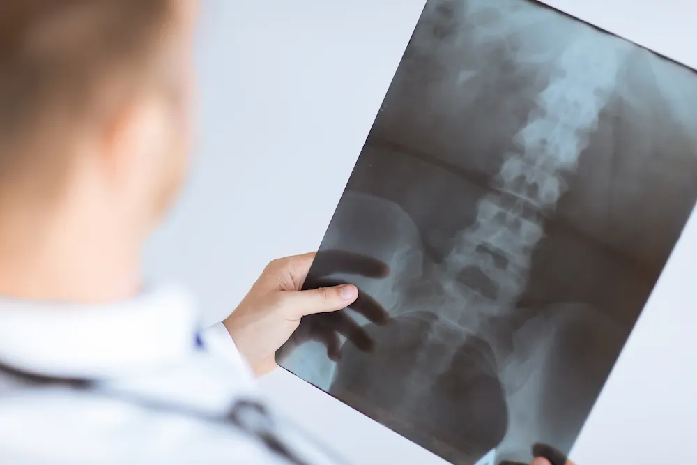 a doctor holding a spinal x -ray scan result