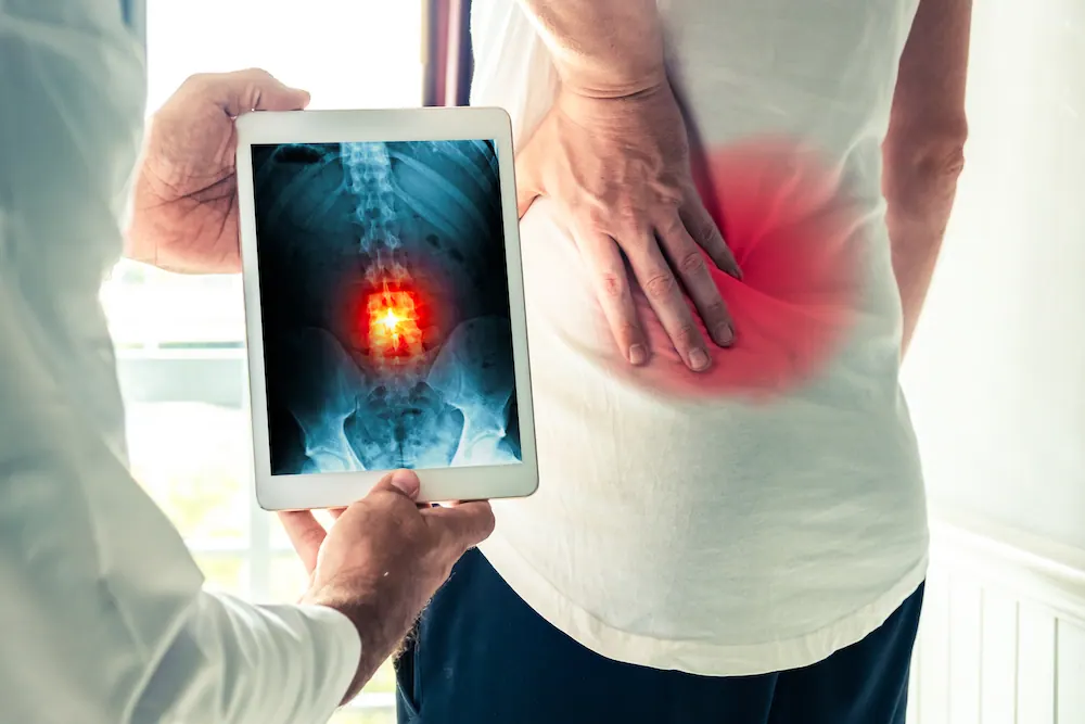 a chiropractor show the result of the spine X-ray result