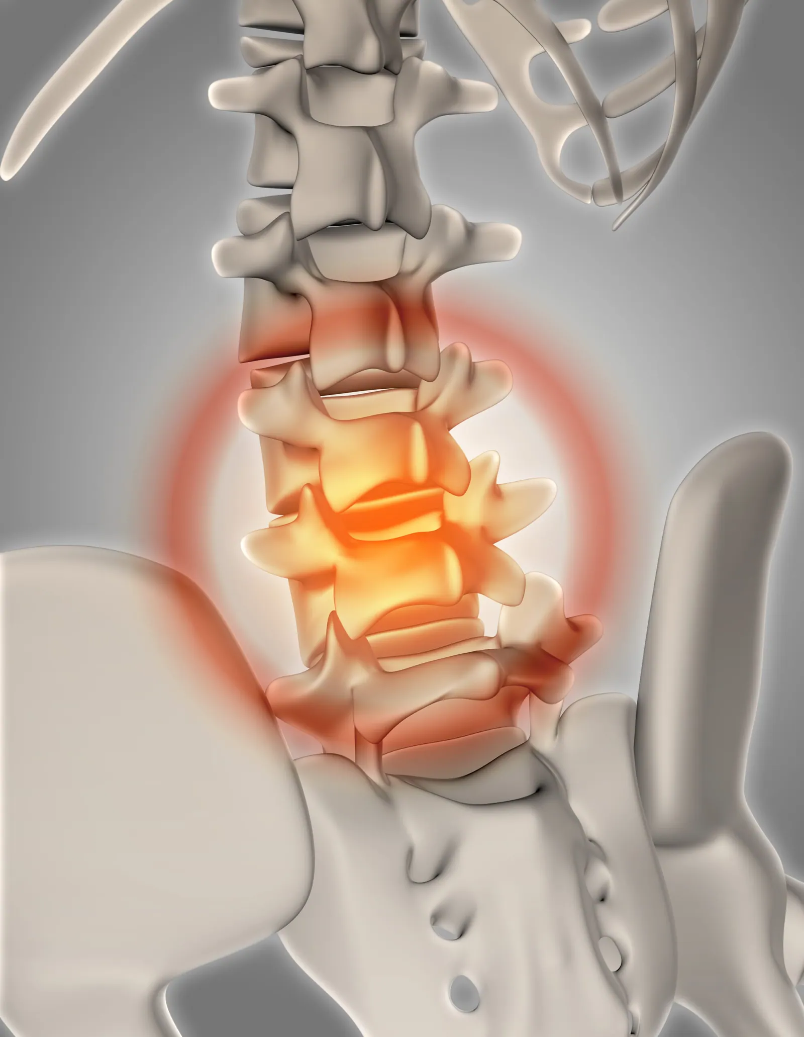 Disc injury solution scaled
